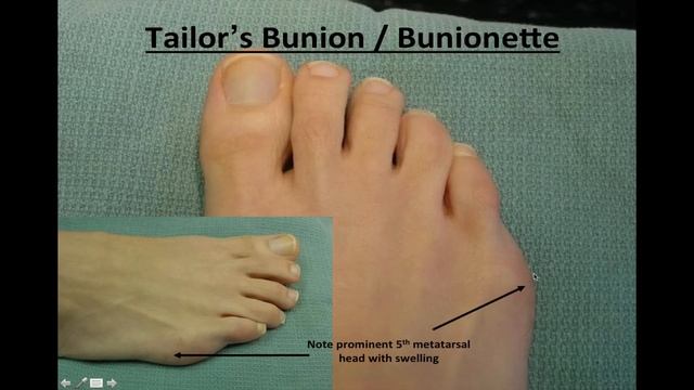 Nail Salon's Guide To Foot and Nail Conditions смотреть онлайн