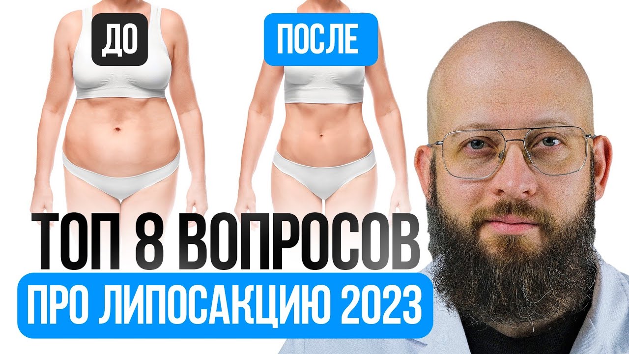ТОП 8 популярных вопросов про ЛИПОСАКЦИЮ. Консультация пластического хирурга. Липосакция 2023 смотреть онлайн