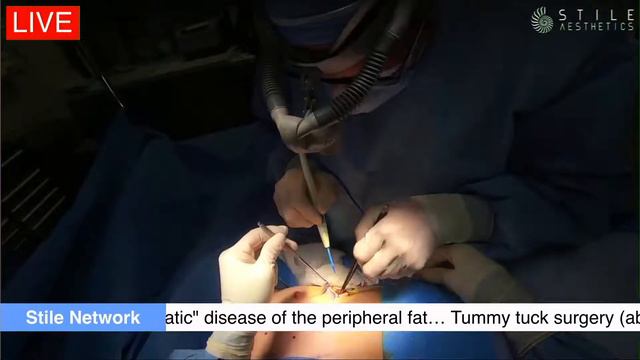 Live Plastic Surgery - Breast Augmentation with Dr. Stile смотреть онлайн