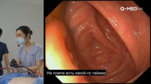 Выполнение колоноскопии под седацией с применением передового аппарата AOHUA | AQ200 | QMED