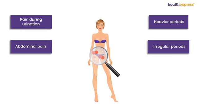 How to know if you have chlamydia: warning signs & symptoms смотреть онлайн