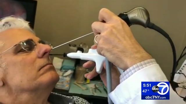 Freeze your allergies away with this treatment смотреть онлайн