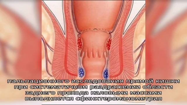Ощущение зуда в заднем проходе после антибиотиков смотреть онлайн