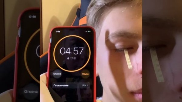 SHIRMER’S TEST. Проба Ширмера