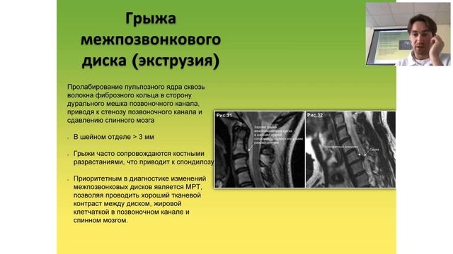 Остеопатическая клиническая диагностика | Вебинар смотреть онлайн