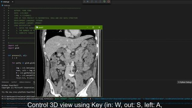 Generating 3D view from 2D CT images! смотреть онлайн
