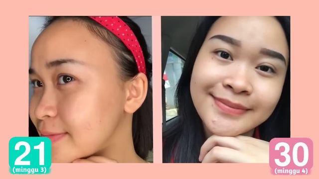 ini muka aku setelah 30 Hari...Efek yang WORK & GAK? (JUJUR & DETAIL) | Some By Mi Cream Toner Seru смотреть онлайн