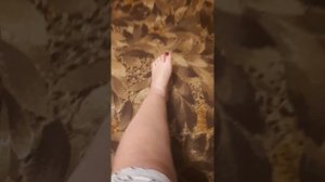 4.5 месяца после остеосинтеза перелома большой берцовой кости