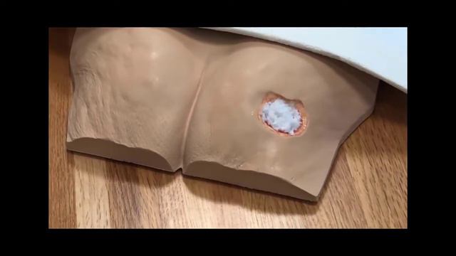 ETS MIRRAGEN Ischium Wound смотреть онлайн