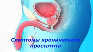 ПРОСТАТИТ У МУЖЧИН. МЕТОДЫ ЛЕЧЕНИЯ ПРИ ПРОСТАТИТЕ. ЗДОРОВАЯ ЖИЗНЬ.