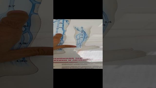 Добавочная вена, варикозная. Готовимся к операции. Флеболог Москва смотреть онлайн