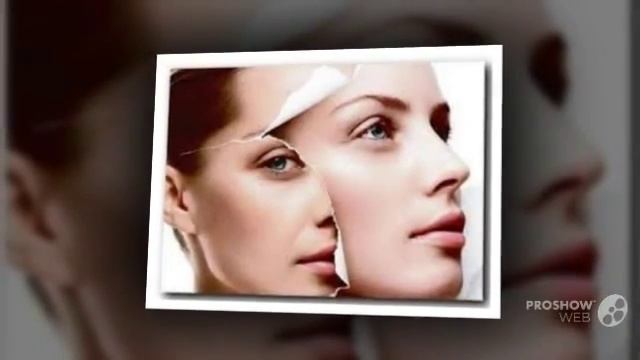 морщина между бровями смотреть онлайн