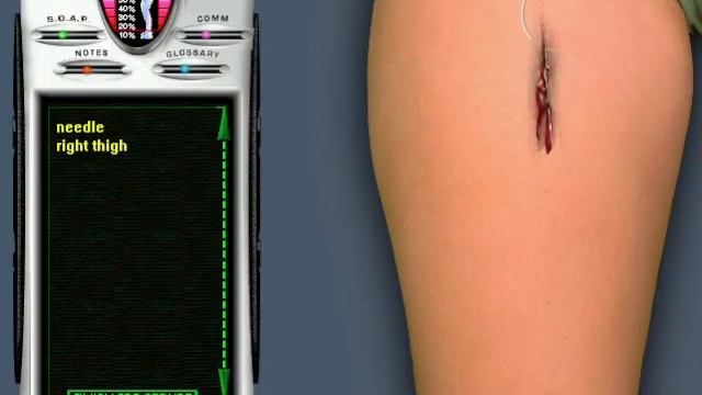 Emergency Room: Life or Death - Case 402 - Thigh injury (Ashlie Gravely, Simple laceration) смотреть онлайн