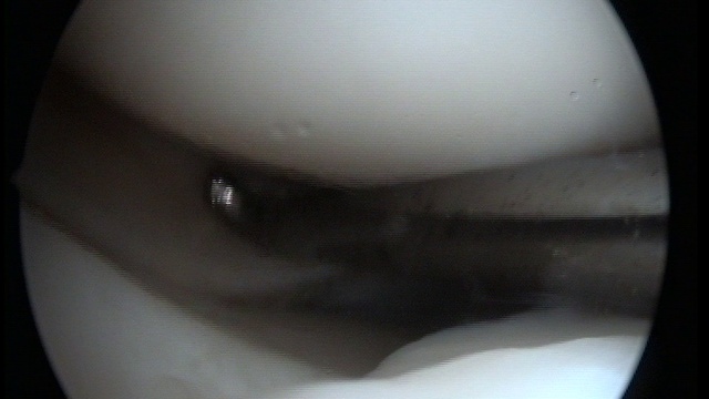 Операция смотреть онлайн