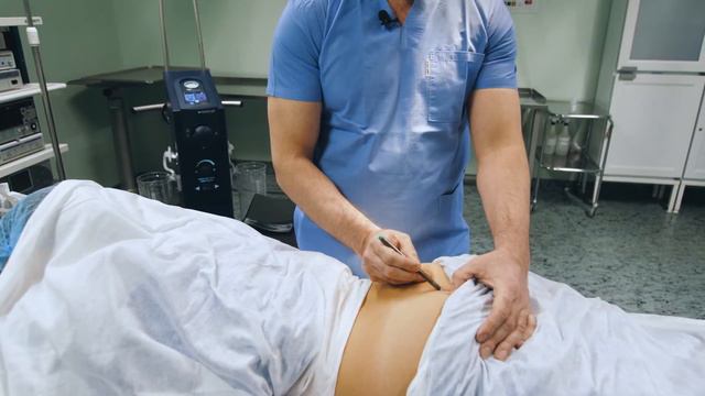 Глютеопластика смотреть онлайн