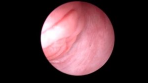 Катетеризация шейки матки у собаки