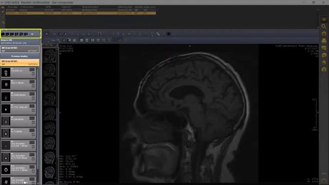 OmniPACS Introduction: The Diagnostic Viewer смотреть онлайн