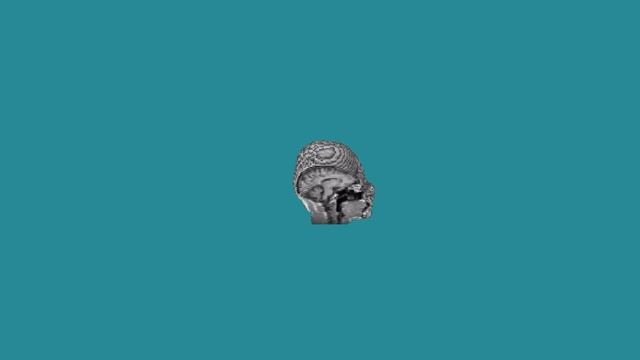 I Tried Generating 3D Models of Heads From MRI Scans смотреть онлайн