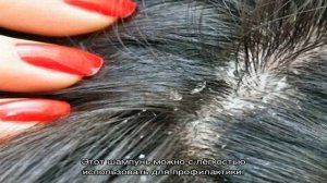 В чем преимущества шампуня Сульсена перед другими средствами против перхоти