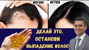 Предотвратите Выпадение Волос И Отрастите Волосы _ Доктор Вивек(1080P_HD).mp4