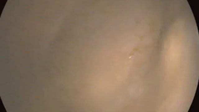 Equine Horse Endoscopy Using PVS3M Video Endoscope And All In One LG200 PC!