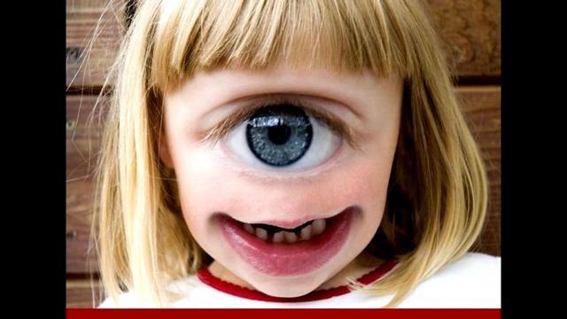 Ребенок родился с одним глазом в середине лба. Невероятная история! смотреть онлайн