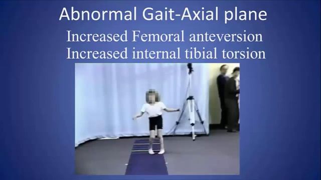 Understanding & Analyzing Gait For The Clinician: Part 06B [Coronal & Axial Plane] смотреть онлайн