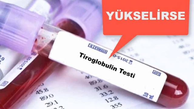 Tiroglobulin Tiroid Kanserinde Ne İşe Yarar? смотреть онлайн
