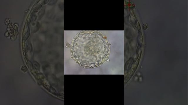 ❄️ЭМБРИОНДЫ ҚАТЫРУ ӘДІСІ ❄️ смотреть онлайн