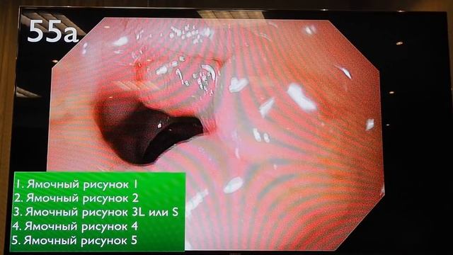 10 Тест по классификации Kudo