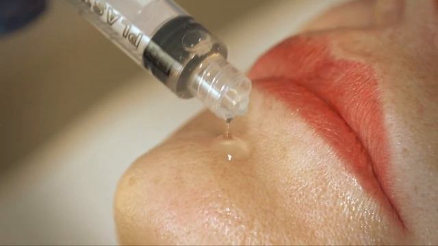 Peeling biorevitalisant PRX T33 Toulouse: centre dermolaser смотреть онлайн