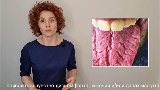 Как жить с таким языком? Складчатый язык смотреть онлайн