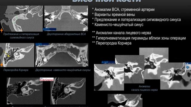 КТ ВИС 4 часть смотреть онлайн