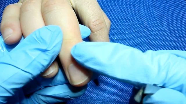 Как избавиться от заусенцев в домашних условиях смотреть онлайн