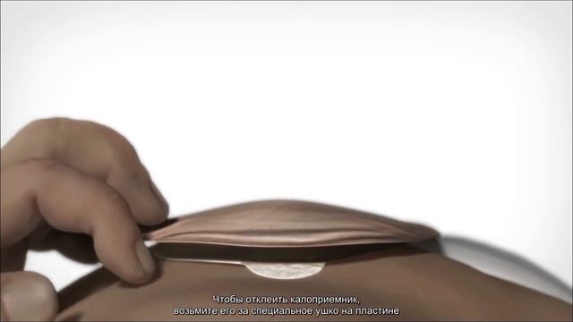 Однокомпонентный калоприемник Coloplast (Колопласт) - как пользоваться калоприемником