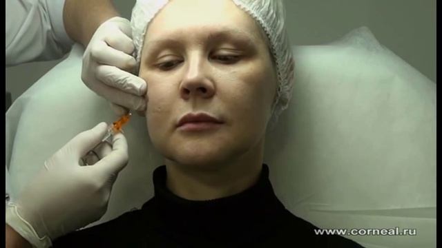 Варианты того, как можно повлиять на область вокруг глаз смотреть онлайн