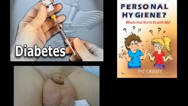 balanitis смотреть онлайн