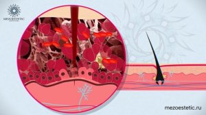 Мезороллер - что это?