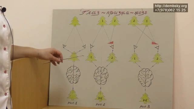 Аппарат Елочка. Глазные тренажеры. смотреть онлайн