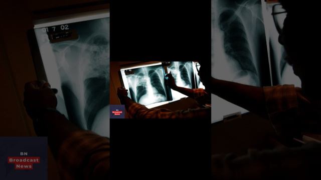 Woman with tuberculosis faces jail and forced treatment after she refused isolation and visited a c смотреть онлайн