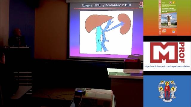 Портокавальное шунтирование у больных циррозом печени и при внепеченочной портальной гипертензии