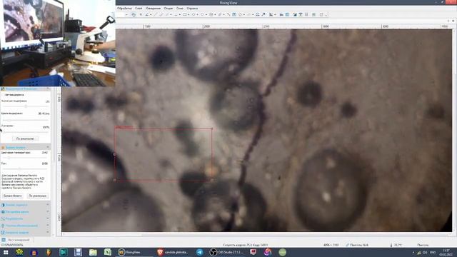 Candida Glabrata . Кандида Глабрата в легких. Микроскопический анализ мокроты. Seilwurm Labor Berli