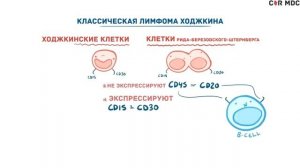 Лимфома Ходжкина - виды, причины, патогенез