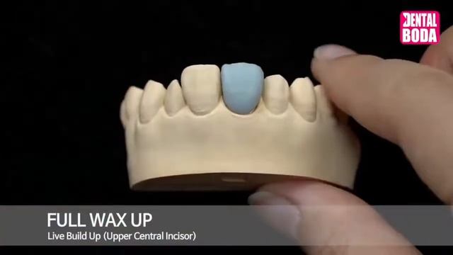 Waxup.(моделирование из воска) Резец