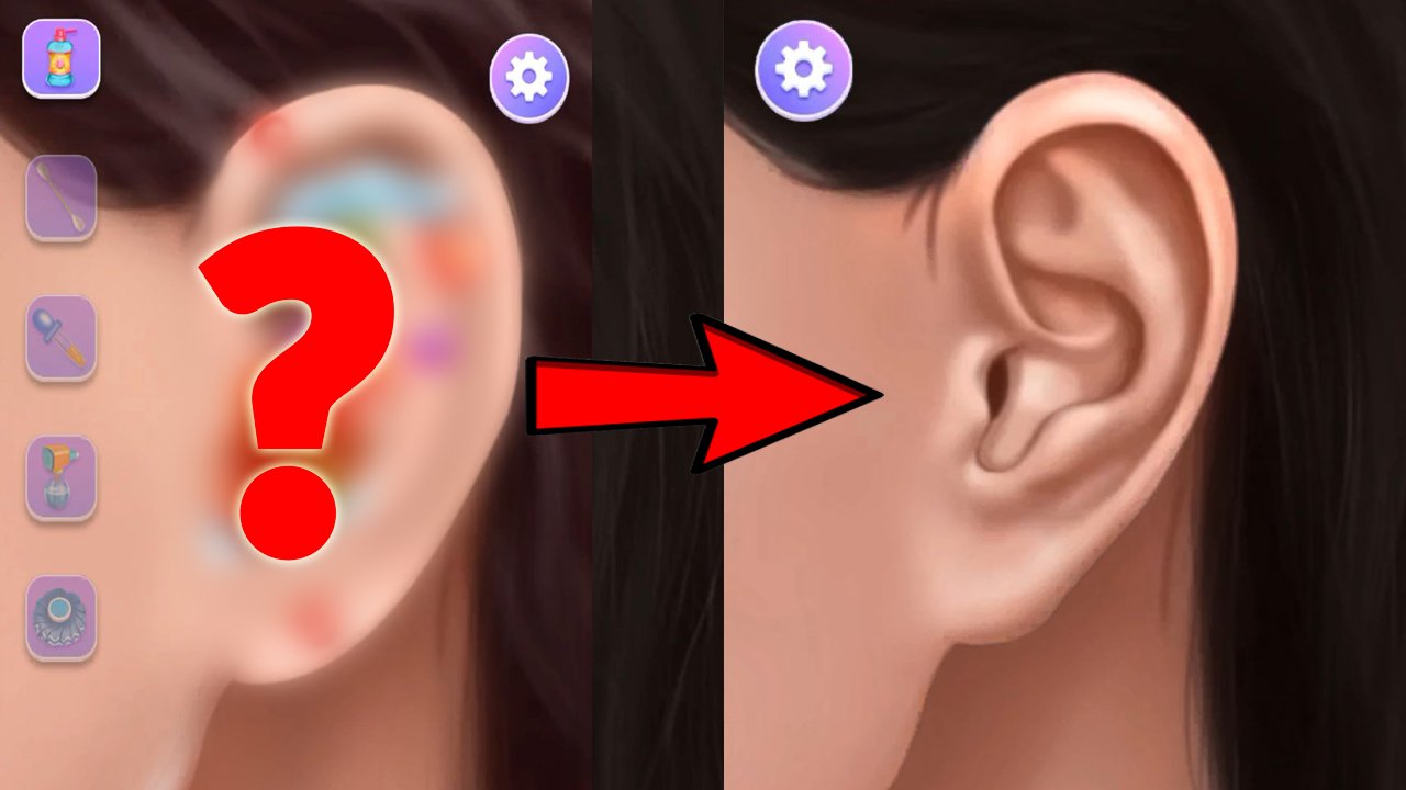 Черные точки в ушах. Волосы в ушах. Прыщи в ушах. Чистка ушей. Реалистичная игра на Андроид