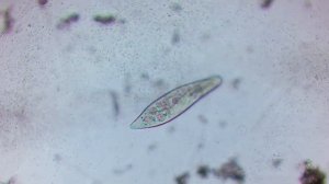 Что можно УВИДЕТЬ В КАПЛЕ ВОДЫ ИЗ ОЗЕРА под микроскопом ?