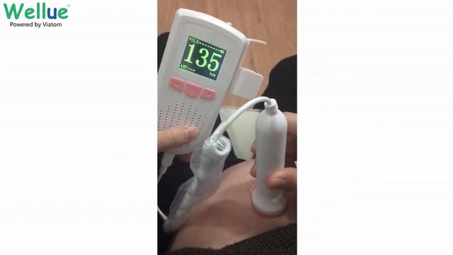 Babytone - magzati szívhang monitor működése смотреть онлайн