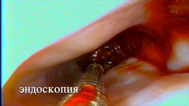 Удаление инородного тела(кость) у йоркширского терьера. смотреть онлайн