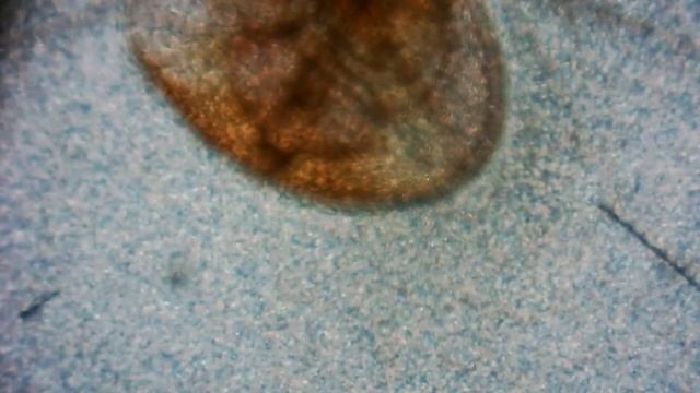 Ротовой аппарат комара - Mosquito proboscis смотреть онлайн