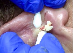 Акне Залипающая подборка видео из Тик Ток